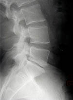 x-ray